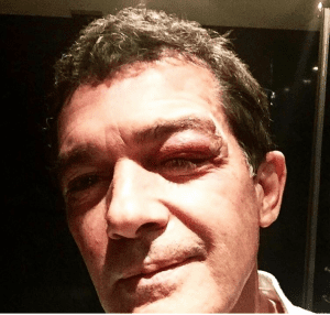 SHINER: Banderas bashed