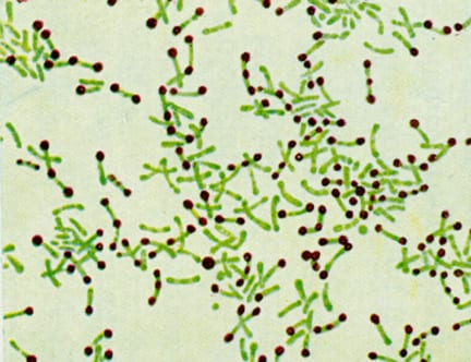 diptheriabacteria