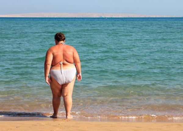 Obesity Spain