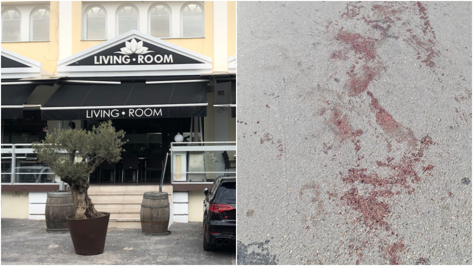 Exclusive Photos Reveal Aftermath Of Marbella Shooting That Left British Man In Critical Condition After Bullet To The Face Olive Press News Spain