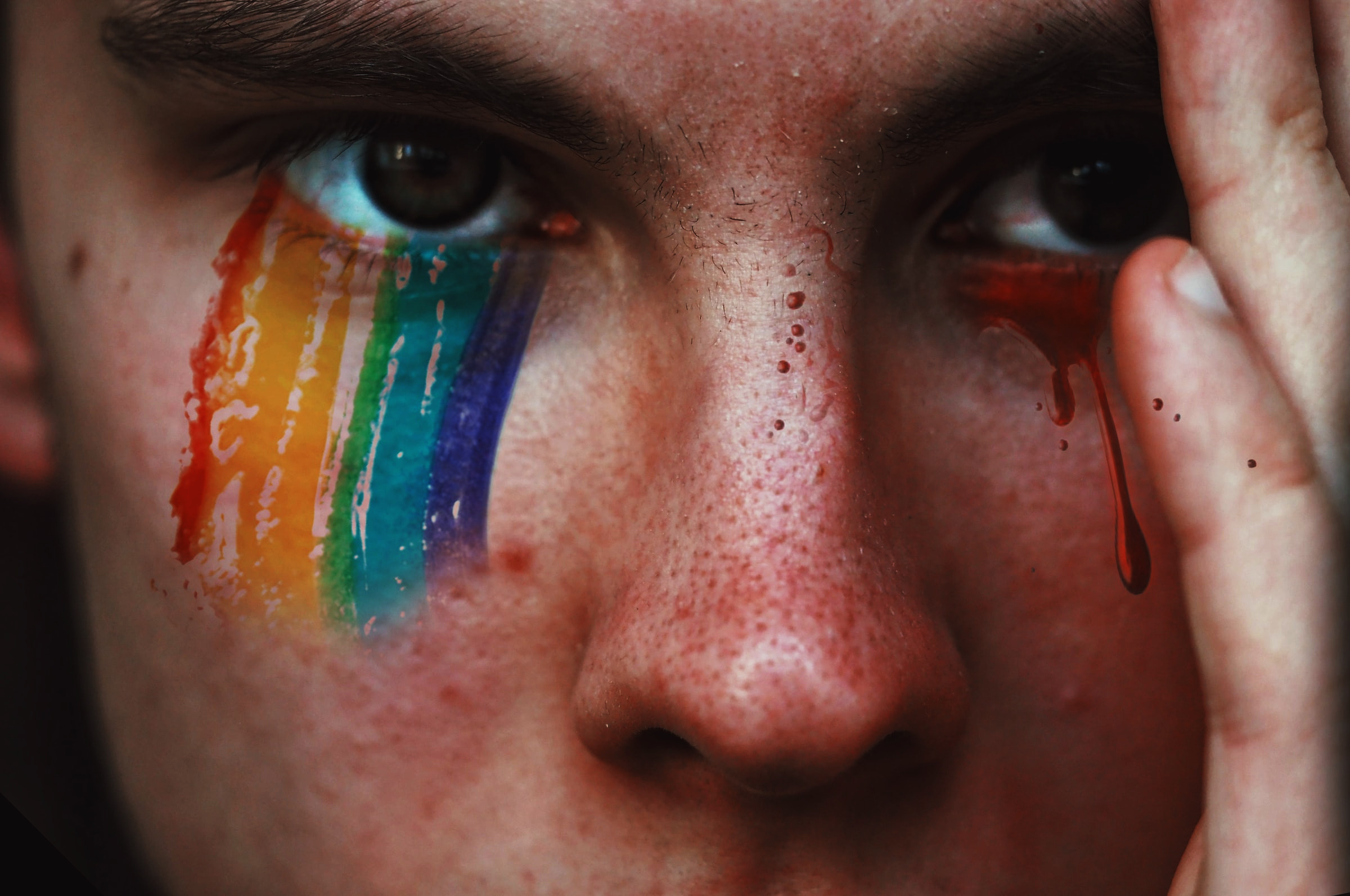 Lgb Homphobia Unsplash