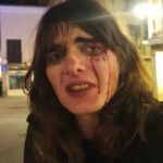 'I'm so scared': Trans woman suffers horrific attack on the streets of Madrid