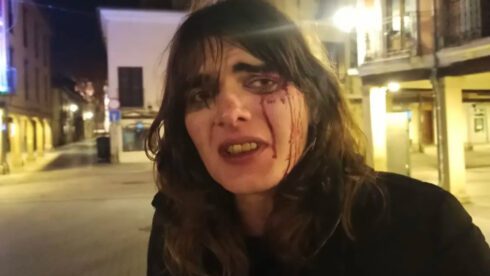 'I'm so scared': Trans woman suffers horrific attack on the streets of Madrid